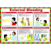 External Bleeding Poster